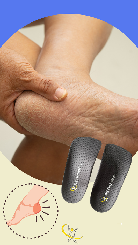 Why One Orthotic Insoles for Multiple Problems Matters in UK?